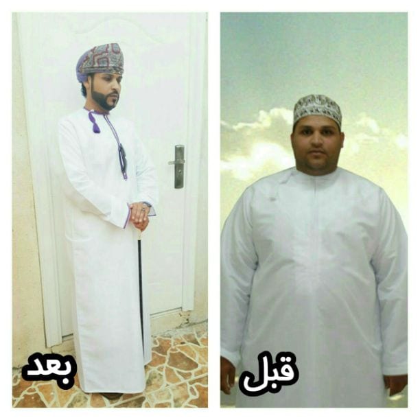 استشاري تغذية علاجية
تخفيف وزيادة الوزن
انظمة غذائية مناسبة لمرضي السكرى والضغط والكوليسترول والحامل والمرضع والأطفال
نزوى فرق بجوار مستشفى بدر السما
#دكتورمحمدعبدالسلام
٩٣٦٩٨٣٣٣
٩٥٥١٣٧٦٧